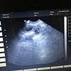 Ultrasound services available