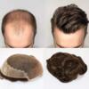 Get 100% natural human hair patches for men and women