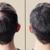 Thicker Hair, Stronger Dad – Father's Day Hair Loss Solution