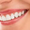Best Teeth Whitening in Dubai at Gloss Smile Dental Care